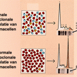 ziekte-van-kahler